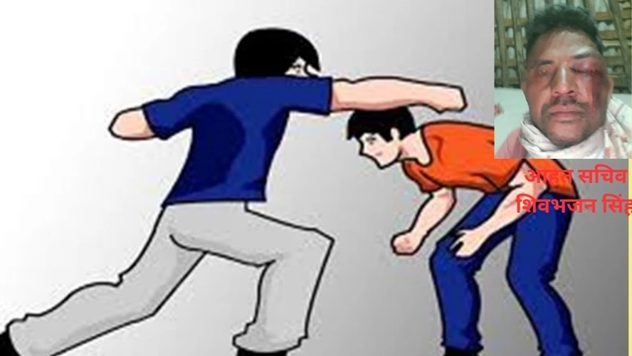 सरपंच के शराबी पुत्र ने पंचायत सचिव का आंख फोड़ा